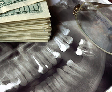 dental xray with a pile of money